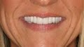 Charlotte Dentist | Adult Dentistry of Ballantyne image 1