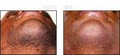 Cosmetic Laser Hair Removal & Beauty Spa image 5