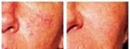 Cosmetic Laser Hair Removal & Beauty Spa image 7