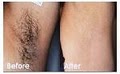 Cosmetic Laser Hair Removal & Beauty Spa image 9