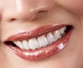Dentist Deltona FL Family and Cosmetic image 5