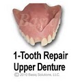 Denture Repairs - BASIQ Dental Solutions image 7