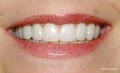 Fremont Dentist - Sheila Dobee Dds image 4