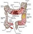 Holistic Colon Detox image 2