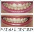 M Dhulab DMD-Emergency Dental-Family Dentist-Invisalign-Dental Implants-Crowns image 3