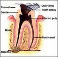 M Dhulab DMD-Emergency Dental-Family Dentist-Invisalign-Dental Implants-Crowns image 8