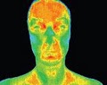 Medical Thermal Imaging & Medical Colonics image 2