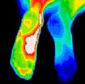 Medical Thermal Imaging & Medical Colonics image 3