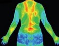 Medical Thermal Imaging & Medical Colonics image 4