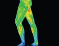 Medical Thermal Imaging & Medical Colonics image 5