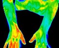Medical Thermal Imaging & Medical Colonics image 6
