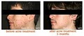 Mill Creek Skin & Laser Center image 3