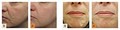 Mill Creek Skin & Laser Center image 5