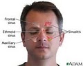 NY Sinus and Allergy  Center image 4