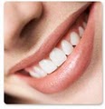 Noblesville Dentist Services image 9