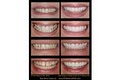 Rebecca Pitts Cosmetic & Advanced Dentistry image 2