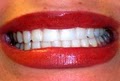 Ron Albright DDS, Nampa Complete Dental image 6