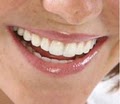 Smile Secrets by Dr Kari Chellis West Seattle Dentistry image 3