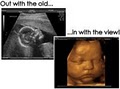 The Inside Story Ultrasound image 1