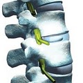 WellSpine Decompression image 2