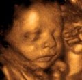 4D Fetal Imaging - 3D 4D Ultrasound near South San. Francisco image 2