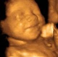 4D Fetal Imaging - 3D 4D Ultrasound near South San. Francisco image 3