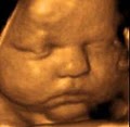 4D Fetal Imaging - 3D 4D Ultrasound near South San. Francisco image 4