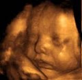 4D Fetal Imaging - 3D 4D Ultrasound near South San. Francisco image 1