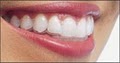 4th Street Dental Spa image 5