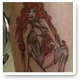 Atlantic Laser Tattoo Removal image 2