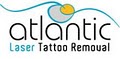 Atlantic Laser Tattoo Removal logo