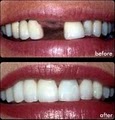 Dallas Dental Implants image 1