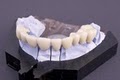 Dentures and Dental Services of Arlington image 7
