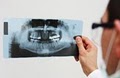 Dentures and Dental Services of Arlington image 8