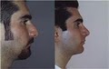 Dr. Ruben Abrams Plastic Surgery image 1