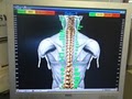 Hi-Tech Chiropractic image 5