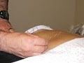 Holistic Acupuncture Clinic image 3