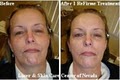 Laser and Skin Care Center of Nevada image 5