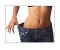Liposuction & Cosmetic Surgery Institute image 3