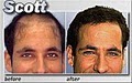 Medical Hair Restoration image 3
