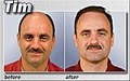 Medical Hair Restoration image 6
