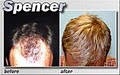 Medical Hair Restoration image 7
