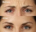 Miami Dermatogist Center for Cosmetic Enhancement image 3