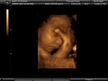 Prenatal Peek image 2