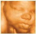 Stork Vision  3D and 4D Ultrasound Prenatal Imaging Centers image 3