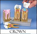 Terrel Myers DDS *Local Dentistry Sedation*Crowns*Dentures*TMJ*Root Canals image 4