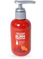 The Burn Cure - Burn Cream - Immediate Relief, Speeds Healing & Reduces Scarring image 5