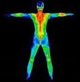 Thermography Center of Ventura image 2