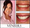 White Flint Dental Associates: Allick, H David DDS-Invisalign,Veneers,Crowns,Tmj image 5