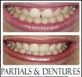 White Flint Dental Associates: Allick, H David DDS-Invisalign,Veneers,Crowns,Tmj image 8